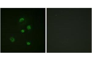 Immunofluorescence analysis of A549 cells, using CHOP (Phospho-Ser30) Antibody. (DDIT3 Antikörper  (pSer30))