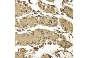 Immunohistochemistry of paraffin-embedded human stomach using SETD5 antibody (ABIN4905135) at dilution of 1:100 (40x lens). (SETD5 Antikörper)