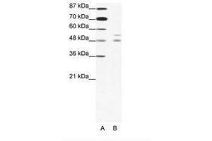 Image no. 1 for anti-Microphthalmia-Associated Transcription Factor (MITF) (N-Term) antibody (ABIN203124) (MITF Antikörper  (N-Term))