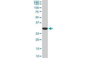 PPIE monoclonal antibody (M02), clone 2F5. (PPIE Antikörper  (AA 2-100))