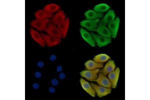 ABIN7096638 and ABIN7100703 staining Hela cells by IF/ICC. (Bax Inhibitor 1 Antikörper)