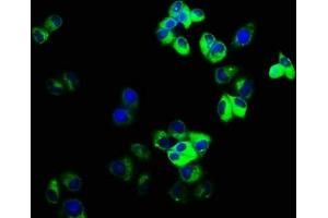Immunofluorescence staining of Hela cells with ABIN7153633 at 1:166, counter-stained with DAPI. (GJD2 Antikörper  (AA 99-197))