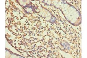 Immunohistochemistry of paraffin-embedded human small intestine tissue using ABIN7167765 at dilution of 1:100 (ALDH1A1 Antikörper  (AA 202-501))
