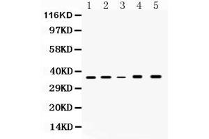 Western blot analysis of GAPDH expression in rat brain extract ( Lane 1), rat kidney extract ( Lane 2), mouse kidney extract ( Lane 3), HELA whole cell lysates ( Lane 4) and MCF-7 whole cell lysates( Lane 5). (GAPDH Antikörper  (AA 136-335))