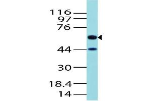 Image no. 1 for anti-Activin A Receptor Type II-Like 1 (ACVRL1) (AA 326-503) antibody (ABIN5027021)