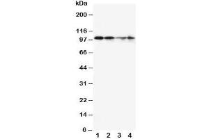 Western blot testing of MCM2 antibody and Lane 1:  SW620;  2: PANC;  3: Jurkat;  4: HeLa cell lysate. (MCM2 Antikörper  (C-Term))