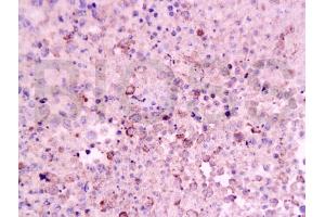 Formalin-fixed and paraffin embedded mouse lymphoma tissue labeled Anti-CD8 Polyclonal Antibody, Unconjugated (ABIN671391) at 1:200, followed by conjugation to the secondary antibody and DAB staining (CD8 Antikörper  (AA 51-150))