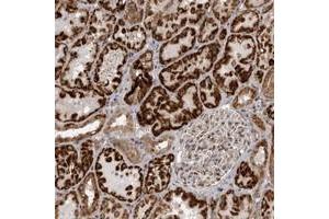 Immunohistochemical staining of human kidney with C1orf109 polyclonal antibody  shows strong cytoplasmic positivity in cells of renal tubles. (C1ORF109 Antikörper)