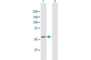 Western Blot analysis of CYP4F22 expression in transfected 293T cell line by CYP4F22 MaxPab polyclonal antibody. (CYP4F22 Antikörper  (AA 1-531))