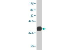 Western Blot detection against Immunogen (36. (LIM Domain Kinase 1 Antikörper  (AA 548-647))