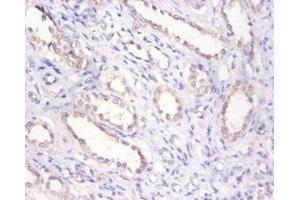 Immunohistochemistry of paraffin-embedded human kidney tissue using ABIN7145696 at dilution of 1:100 (BMP6 Antikörper  (AA 382-513))