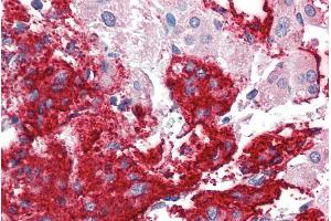 Immunohistochemistry (IHC) image for anti-Neuroligin 2 (NLGN2) (Internal Region) antibody (ABIN190848)