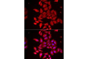Immunofluorescence analysis of U2OS cell using TMOD4 antibody. (Tropomodulin 4 Antikörper)