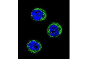 Confocal immunofluorescent analysis of HP Antibody (Center) (ABIN654637 and ABIN2844334) with MDA-M cell followed by Alexa Fluor 488-conjugated goat anti-rabbit lgG (green). (Haptoglobin Antikörper  (Center))