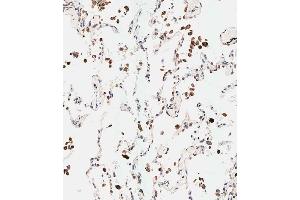 Immunohistochemical analysis of paraffin-embedded human lung tissue using (ABIN653920 and ABIN2843154) performed on the Leica® BOND RXm.
