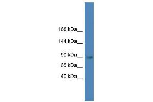 WB Suggested Anti-TLR4 Antibody Titration: 0. (TLR4 Antikörper  (C-Term))