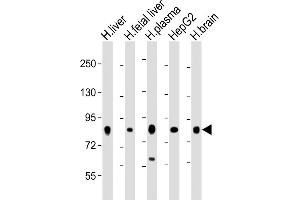 All lanes : Anti-Transferrin Antibody at 1:2000 dilution Lane 1: human liver lysate Lane 2: human fetal liver lysate Lane 3: human plasma lysate Lane 4: HepG2 whole cell lysate Lane 5: human brain lysate Lysates/proteins at 20 μg per lane. (Transferrin Antikörper  (AA 432-466))