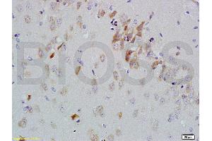 Formalin-fixed and paraffin embedded rat brain labeled with Anti-GDNF-Receptor-alpha-2 Polyclonal Antibody, Unconjugated (ABIN724235) 1:200 followed by conjugation to the secondary antibody and DAB staining (GFRA2 Antikörper  (AA 301-360))