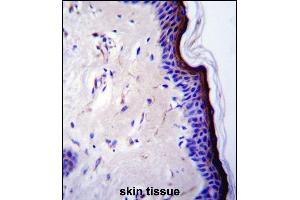 Immunohistochemistry (Paraffin-embedded Sections) (IHC (p)) image for anti-Tumor Protein P53 (TP53) (AA 33-62) antibody (ABIN390200)