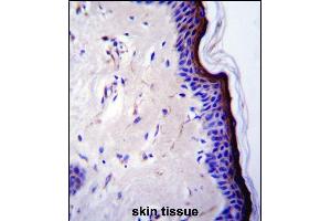 p53 Antibody (T55) (ABIN390200 and ABIN2840687) immunohistochemistry analysis in formalin fixed and paraffin embedded human skin tissue followed by peroxidase conjugation of the secondary antibody and DAB staining. (p53 Antikörper  (AA 33-62))