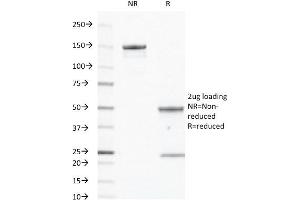 SDS-PAGE Analysis of Purified CD40 Mouse Monoclonal Antibody ABIN6383879. (CD40 Antikörper  (Extracellular Domain))