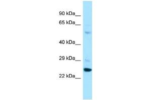 Host: Rabbit Target Name: PARS2 Sample Type: A549 Whole Cell lysates Antibody Dilution: 1. (PARS2 Antikörper  (C-Term))