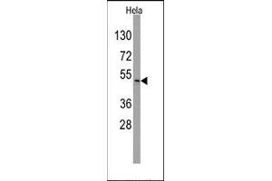 Image no. 1 for anti-Integrin-Linked Kinase (ILK) (Ser246) antibody (ABIN359882)