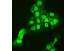 IF analysis of CCT3 using anti-CCT3 antibody (ABIN4886513).