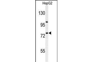 Western blot analysis of ZN Antibody (Center) (ABIN653731 and ABIN2843038) in HepG2 cell line lysates (35 μg/lane). (ZNF202 Antikörper  (AA 342-370))