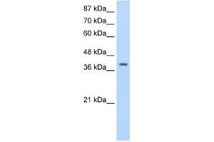 LARP7 antibody used at 1. (LARP7 Antikörper  (C-Term))