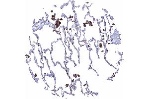 Lung Strong HLA DRB1 staining in alveolar macrophages HLA DRB1 immunohistochemistry (Rekombinanter HLA-DRB1 Antikörper)