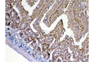 Immunohistochemistry (IHC) image for anti-Adenosine Deaminase (ADA) (AA 2-238) antibody (ABIN5708187)