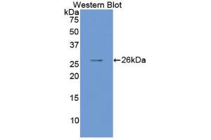 Western blot analysis of the recombinant protein. (SMAD1 Antikörper  (AA 270-465))