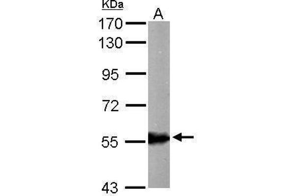 ALDH6A1 Antikörper