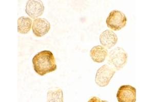 Immunocytochemistry staining of HeLa cells using AP30343PU-N FLIP antibody at 2 μg/ml. (FLIP Antikörper  (C-Term))