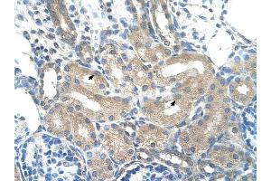 ADH1B antibody was used for immunohistochemistry at a concentration of 4-8 ug/ml to stain Epithelial cells of renal tubule (arrows) in Human Kidney. (ADH1B Antikörper)