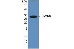 Detection of Recombinant DDIT3, Human using Polyclonal Antibody to DNA Damage Inducible Transcript 3 (DDIT3)