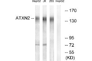 Western blot analysis of extracts from HepG2 cells, Jurkat cells and 293 cells, using ATXN2 antibody. (Ataxin 2 Antikörper)