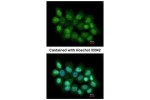 ICC/IF Image Immunofluorescence analysis of paraformaldehyde-fixed A431, using PRMT2, antibody at 1:200 dilution. (PRMT2 Antikörper)