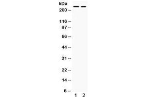 Western blot testing of human 1) SW620 and 2) HepG2 lysate with ARID1A antibody. (ARID1A Antikörper)