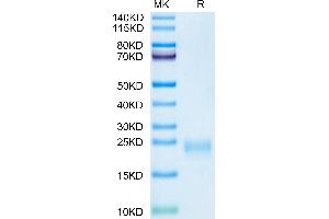 Cynomolgus IL-5 on Tris-Bis PAGE under reduced condition. (IL-5 Protein (AA 20-134) (His tag))