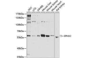 Western blot analysis of extracts of various cell lines, using EPHX2 antibody (ABIN3015667, ABIN3015668, ABIN1679738 and ABIN6219019) at 1:1000 dilution. (EPHX2 Antikörper)