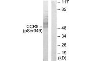 Western blot analysis of extracts from RAW264. (CCR5 Antikörper  (pSer349))