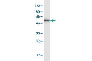 Western Blot detection against Immunogen (52. (PDCL3 Antikörper  (AA 1-239))