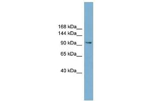 NCAM2 antibody used at 1 ug/ml to detect target protein. (NCAM2 Antikörper  (Middle Region))