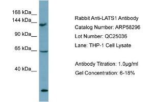 WB Suggested Anti-LATS1  Antibody Titration: 0. (LATS1 Antikörper  (Middle Region))