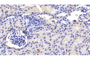 Immunohistochemistry (IHC) image for anti-Insulin Receptor (INSR) (AA 1024-1298) antibody (ABIN7432874)