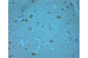 human olfactory-1 (ERK1/2 Antikörper  (pThr202, pTyr204))