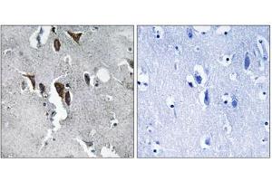Immunohistochemistry analysis of paraffin-embedded human brain tissue using ELOVL5 antibody. (ELOVL5 Antikörper  (C-Term))