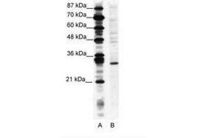 Image no. 1 for anti-Ring Finger Protein 141 (RNF141) (AA 96-145) antibody (ABIN202098)